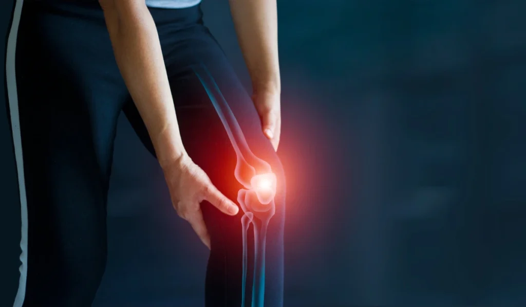 Arthritis Pain - Ivvy Health